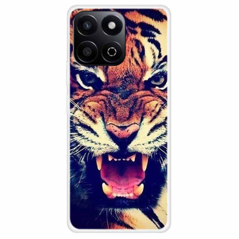 Capa Tiger Honor X7c 4G / 200 Smart 5G