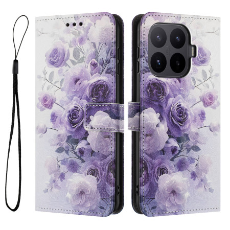 Capa Xiaomi 17T Pro...